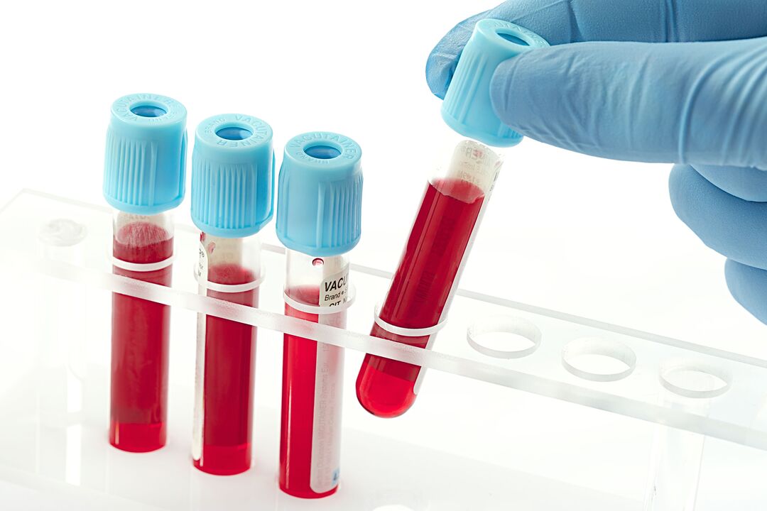 test gjaku për të diagnostikuar papillomavirusin njerëzor