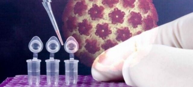 Diagnostifikimi i HPV duke përdorur testin digene